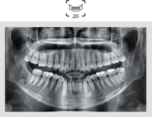 Digital scan of a patient's jaw